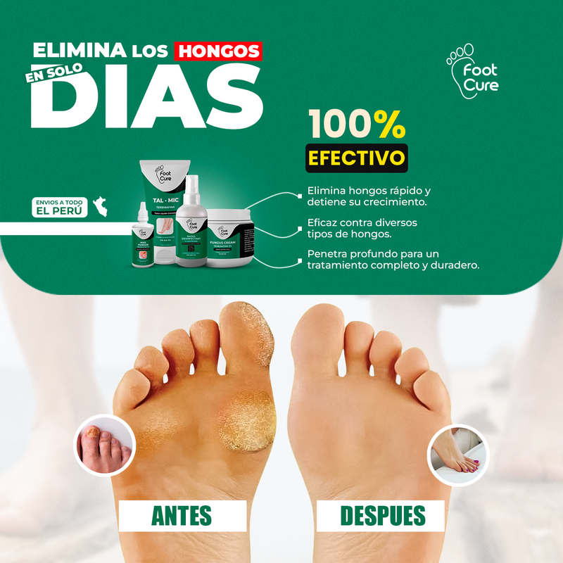 TERBINAFINA GOTAS PARA  HONGOS EN LAS UÑAS