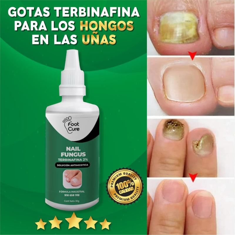 TERBINAFINA GOTAS PARA  HONGOS EN LAS UÑAS